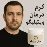 کرم درمان ویتیلیگو ( لکه های سفید )|آرایشی، بهداشتی، درمانی|تهران, فلسطین (میدان انقلاب)|دیوار