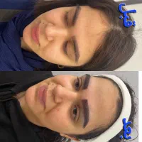 کاشت ابرو، شقیقه، سر، نقدو. اقساط|خدمات زیبایی و سلامت|تهران, فرمانیه|دیوار