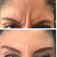 ژل صورت وبادی|خدمات آرایشگری و زیبایی|تهران, سلسبیل شمالی|دیوار