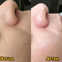 درمان تخصصی پوست و خالبرداری