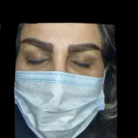 کاشت ابرو دائمی