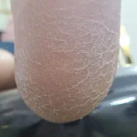 تخفیف ویژه پدیکور و کفسابی تخصصی پا فقط ۳۵۰تومان