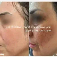 با این کرم فقط با ده روز پوستت رو فوق العاده کن|آرایشی، بهداشتی، درمانی|لردگان, |دیوار