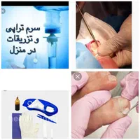 خدمات پرستاری و درمان و برداشتن انواع زگیل|خدمات آرایشگری و زیبایی|یاسوج, |دیوار