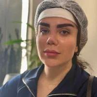 کاشت ابرو تخصصی با خواب موی مناسب پنجاه درصد تخفیف