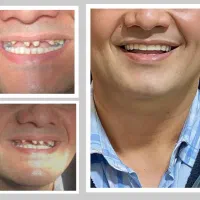 درمان فوری دندان‌درد در پرند با وقت‌دهی سریع