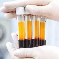 تخفیفات پی ار پیPRP مو و صورت