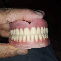 ساخت دندان مصنوعی|آرایشی، بهداشتی، درمانی|لردگان, |دیوار