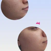 پاکسازی پوست .با بهترین متریال روز دنیا|خدمات آرایشگری و زیبایی|اصفهان, ملک‌شهر|دیوار