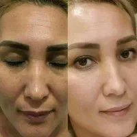 توی ۳ روز سفید برفی و بلوری شو|خدمات آرایشگری و زیبایی|امیدیه, |دیوار