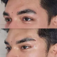 مطب‌دکترژل وبوتاکس.افزایش سایزآلت آقایان.لیفت بانخ|خدمات آرایشگری و زیبایی|قم, صفائیه|دیوار