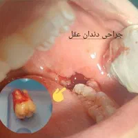 مطب دندانپزشکی واقع در مرکز شهر (نادری )|خدمات آرایشگری و زیبایی|اهواز, نادری|دیوار