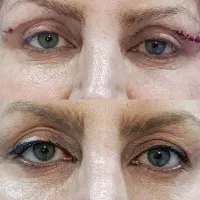 خدمات پوست و زیبایی مجاز|خدمات آرایشگری و زیبایی|شیراز, چوگیاه|دیوار