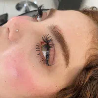 مرکز تخصصی فیبروز به سبک (هایپر نچرال وموی)|خدمات زیبایی و سلامت|کرمانشاه, |دیوار