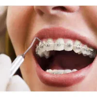 دندانسازی مرکزی ساخت انواع دندان مصنوعی و ارتودنسی|خدمات آرایشگری و زیبایی|یزد, |دیوار