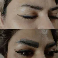 ریموو تتو ابرو و بدن با لیزر.کربن تراپی .کک‌ومک