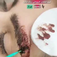 ریموو درمانی تتو های بدرنگ قدیمی|خدمات آرایشگری و زیبایی|الشتر, |دیوار