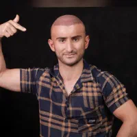 کاشت مو با دوازده میلیون