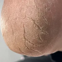 آموزش حرفه ای پدیکور