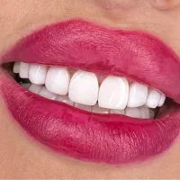نیازمند دندانپزشک