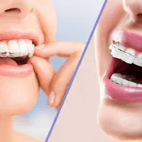 مرکز کامپوزیت، لمینت و ایمپلنت دکتر صبا صباغی|خدمات آرایشگری و زیبایی|شیراز, تاچارا|دیوار