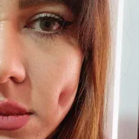 پرسینگ ناخن چال لپ پلاسمامیکرودرمال مرو خال مژه|خدمات آرایشگری و زیبایی|قم, شهرک فاطمیه|دیوار