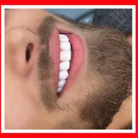 دندانپزشکی/کامپوزیت دندان/ترمیم/روکش/عصبکشی|خدمات آرایشگری و زیبایی|تهران, تهرانپارس شرقی|دیوار