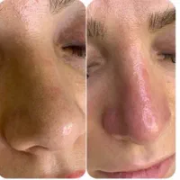 آموزش پاکسازی پوست