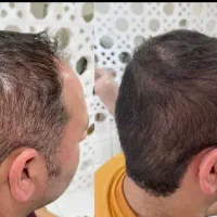 یک بار برای همیشه