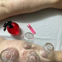 ماساژ اصلاحی