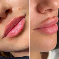 کلینیک لیزر و زیبایی دکتر سرمدی،،خدمات هدیه بگیرید|خدمات آرایشگری و زیبایی|اصفهان, هزارجریب|دیوار