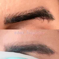 پاک کردن تتو///خدمات لیزر کیوسوئیچ و پیلینگ کربن|خدمات آرایشگری و زیبایی|صدرا-فارس, فاز ۱|دیوار