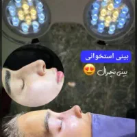 تخفیف لیپو ابدو ۱۱تومن رینوعمل بینی|خدمات آرایشگری و زیبایی|تهران, آهنگ|دیوار