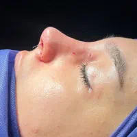 تخفیف ویژه جراحی بینی همین حالا|خدمات آرایشگری و زیبایی|تهران, ازگل|دیوار