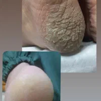 خدمات کاشت ناخن|خدمات آرایشگری و زیبایی|زرند, |دیوار