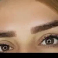 کاشت مژه هیدن