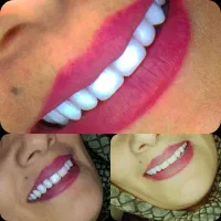 دندانسازی مظفری با مجوز رسمی تحویل فوری