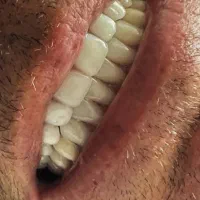 دندان سازی|پزشکی|ارومیه, |دیوار