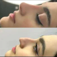 تخصص حرفه ای تزریق لب روسی|خدمات آرایشگری و زیبایی|ارومیه, |دیوار