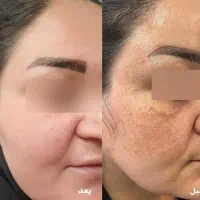 کرم سفید کننده اماراتی اصل