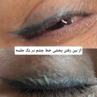 تخفیف ریمو تتو به مدت محدود|خدمات آرایشگری و زیبایی|تهران, تهرانپارس غربی|دیوار