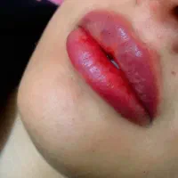 پروتزلب|خدمات آرایشگری و زیبایی|زابل, |دیوار