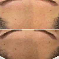 آموزش تخصصی فیشیال وپاکسازی پوست با مدرک