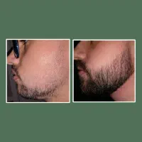 روغن 39روزه|آرایشی، بهداشتی، درمانی|کرمانشاه, |دیوار