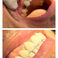 دندانپزشکی دنو اقساطی با چک یا سفته