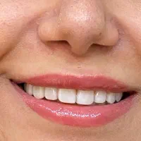 کامپوزیت لب شیشه ای اقساطی|خدمات آرایشگری و زیبایی|اصفهان, کوی ولی عصر|دیوار