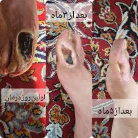 پاکسازی و اصلاح مزاج
