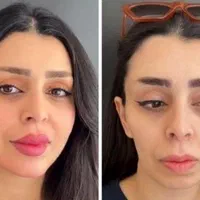 فیلر بادی ژل لب بوتاکس نخ لیفت فیلر بینی آنزیم لب|خدمات آرایشگری و زیبایی|اصفهان, باغ نگاره|دیوار