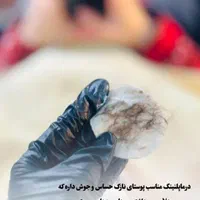 دستگاه فشیال درما پلنینگ . پاکسازی و آبرسانی|آرایشی، بهداشتی، درمانی|زابل, |دیوار