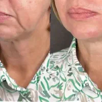 نتیجه رو نگاه